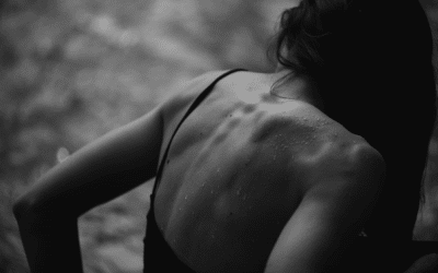 Can Scoliosis Cause Migraines?